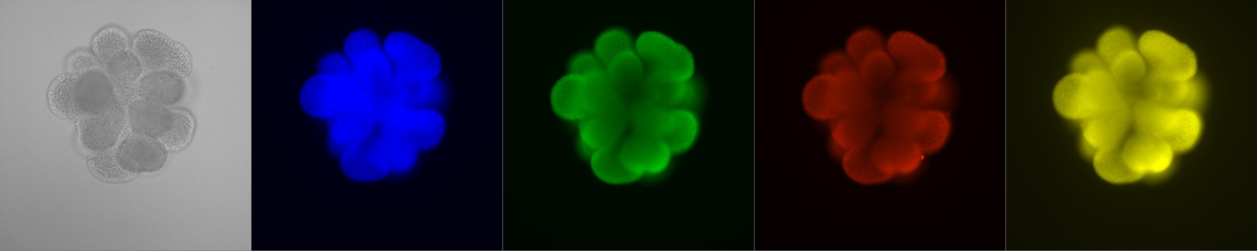 Stem cell derived fetal lung organoid. Blue is dapi, green is the lung marker NKX2-1 (TTF1), red is SOX9 and Yellow is SOX2. These branching organoids make up 10-30% of the organoid cultures we get and now we can image these organoids with spectacular single cell spatial resolution.