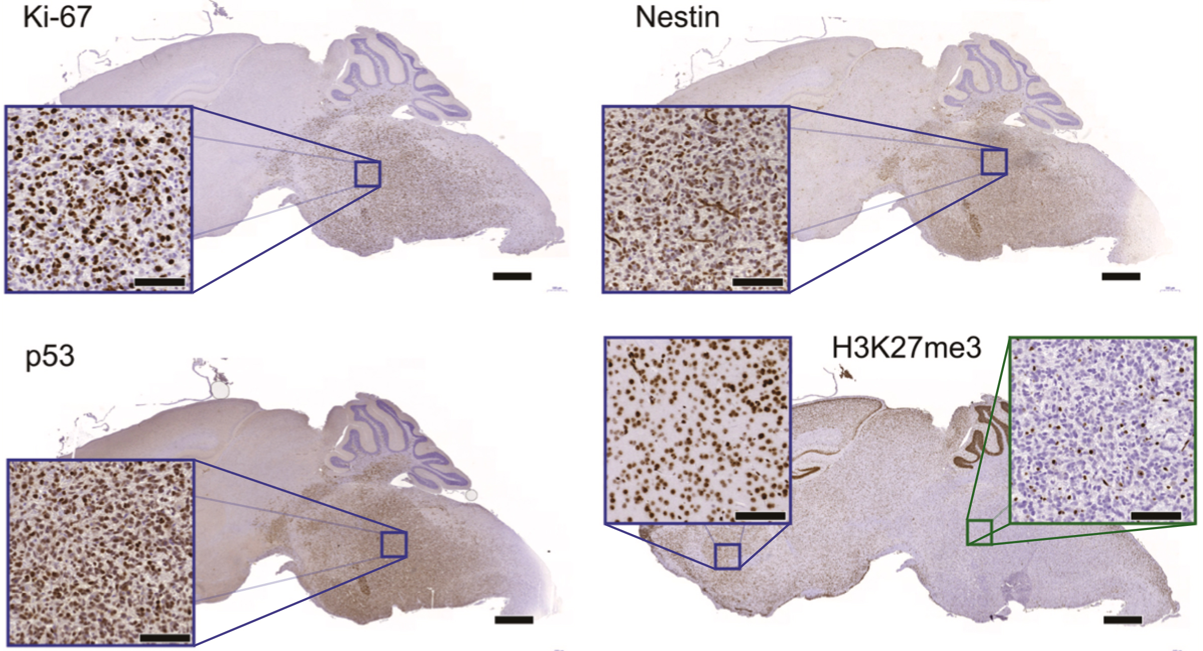 Image of four mouse brains (sagittal sections) with magnified areas of cells showing the expression of four molecular markers (Ki-67, Nestin, p53, H3K27me3).