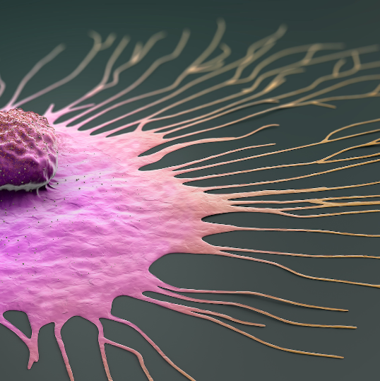 3D rendering of a migrating cancer cell. The cell is pink with a dark purple nucleus and orange filaments extending outward. The background is a dark grey gradient.