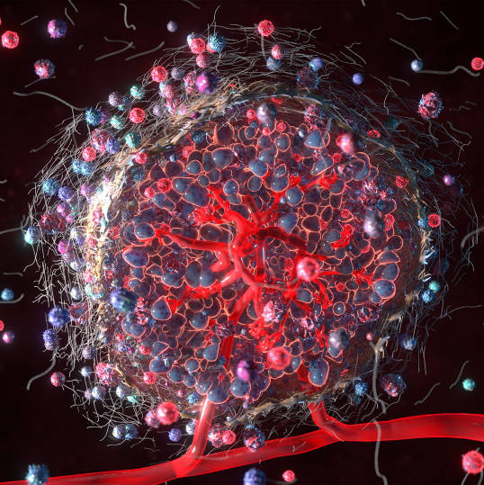 3D Rendering of an isolated tumor microenvironment. The tumour core is made of vascularized, closely packed, dark blue and purple cells. Single cells extend out into the surrounding environment.