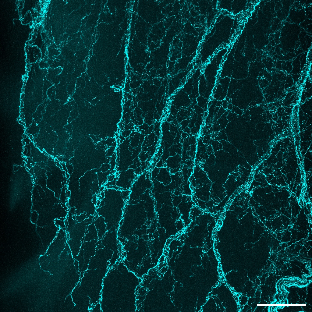 Adipose tissue immunofluorescent image highlighting the nerve fibres in blue.
