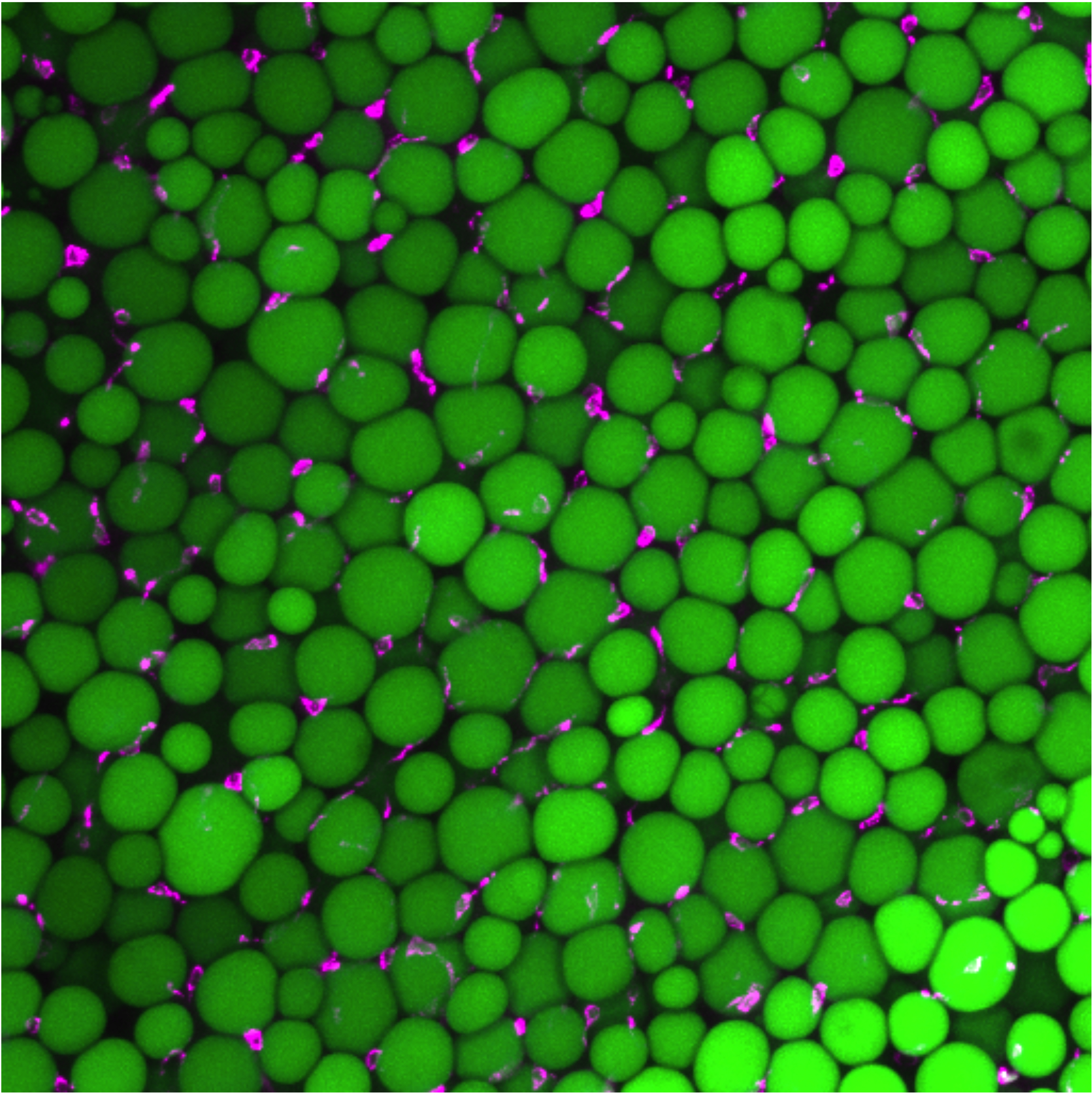 Adipose tissue immunofluorescent image showing adipocytes containing big round lipid droplets in bright green.