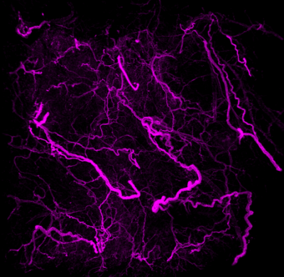 Adipose tissue immunofluorescent image highlighting the complex network of blood vessels in purple.
