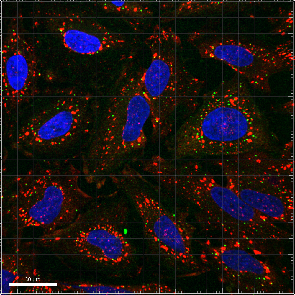 immunofluorescence image of human HeLa cells stained with stress granule markers.