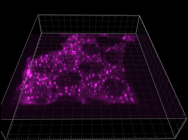 Purple fluorescence image showing stress granules in HAP1 cells.