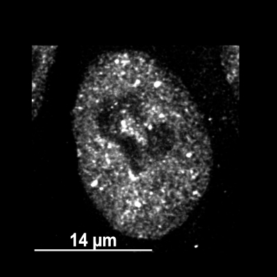 black and white immunofluorescence image of a HAP1 cell with visible stress granules.