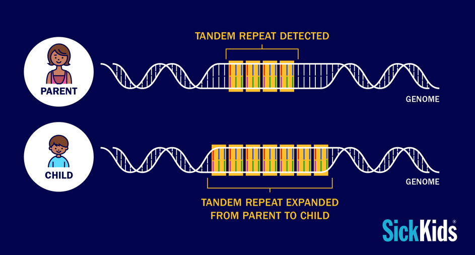 Diagram showing DNA with a tandem repeat detected in parent, and expanded in the child